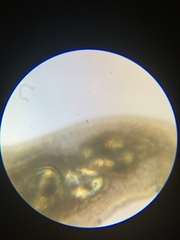 Macrostomum