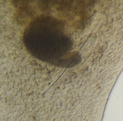 Macrostomum tuba