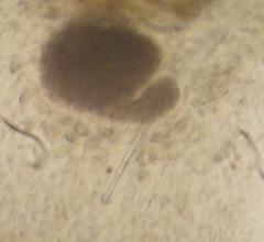 Macrostomum tuba