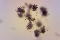 Microcystis