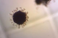 Dolichospermum