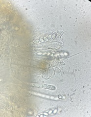 Coprotus