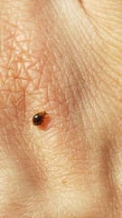 Adoxellus flavihirtus