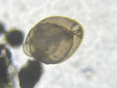 Globobulimina