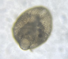 Globobulimina