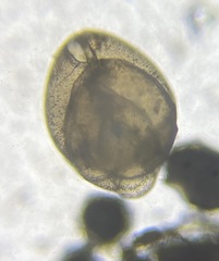 Globobulimina