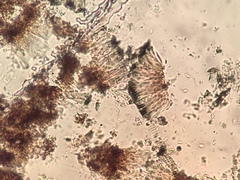 Leimonis erratica