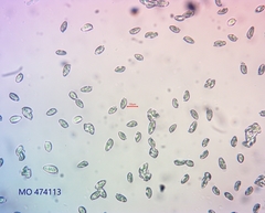 Chrysomphalina chrysophylla