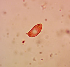 Chrysomphalina chrysophylla