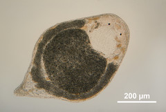 Microdalyellia