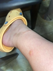 Eutrombicula alfreddugesi