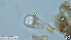 Euglypha acanthophora