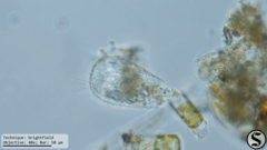 Euglypha acanthophora
