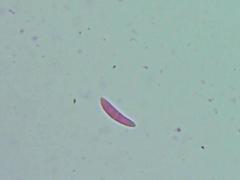 Mitrula lunulatospora