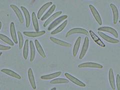 Mitrula lunulatospora