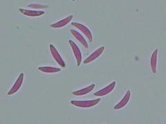 Mitrula lunulatospora