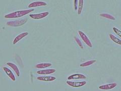 Mitrula lunulatospora