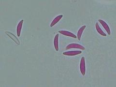 Mitrula lunulatospora