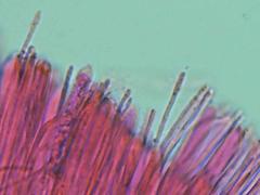 Mitrula lunulatospora