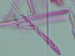 Mitrula lunulatospora