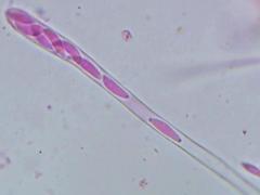 Mitrula lunulatospora