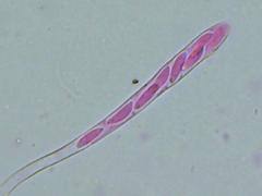 Mitrula lunulatospora