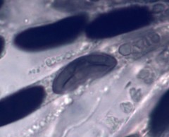 Rosellinia britannica