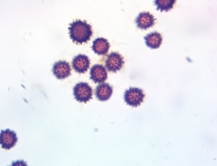 Scleroderma flavidum