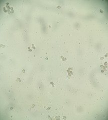 Coprinopsis cineraria