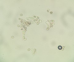 Coprinopsis cineraria