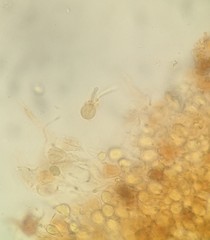 Phaeotremella fimbriata