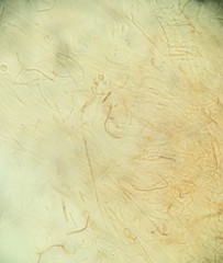 Phaeotremella fimbriata