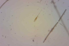 Climacosphenia moniligera