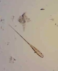 Climacosphenia moniligera