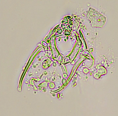 Encentrum torvitoides
