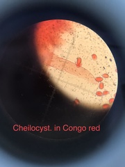 Leucoagaricus croceovelutinus