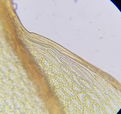 Ptychostomum pseudotriquetrum