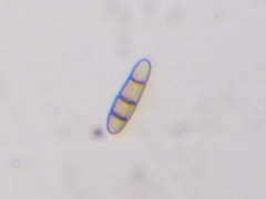 Hysterium angustatum