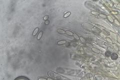 Peziza echinospora
