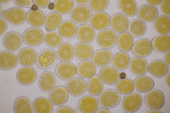 Pucciniastrum symphyti