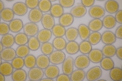 Pucciniastrum symphyti