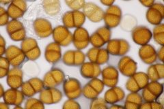 Puccinia chaerophylli retifera