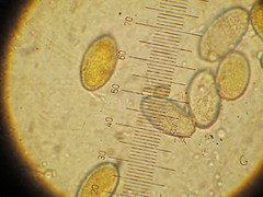 Peziza echinospora
