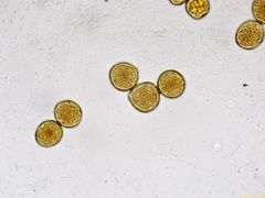 Gymnosporangium clavariiforme