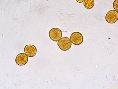 Gymnosporangium clavariiforme