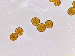 Gymnosporangium clavariiforme