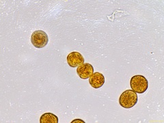 Gymnosporangium clavariiforme