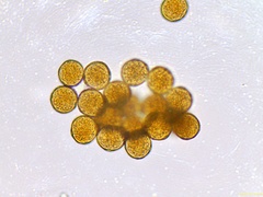 Gymnosporangium clavariiforme
