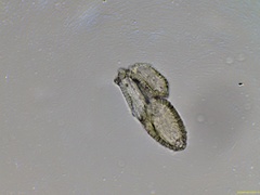 Gymnosporangium clavariiforme