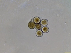 Gymnosporangium clavariiforme